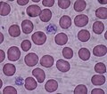 Article: Platelet ?